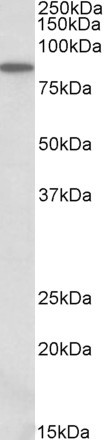 ALDH18A1 Antibody in Western Blot (WB)