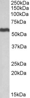 ALDH5A1 Antibody in Western Blot (WB)