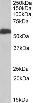 ALDH5A1 Antibody in Western Blot (WB)