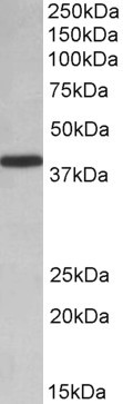 PCBP1 Antibody in Western Blot (WB)