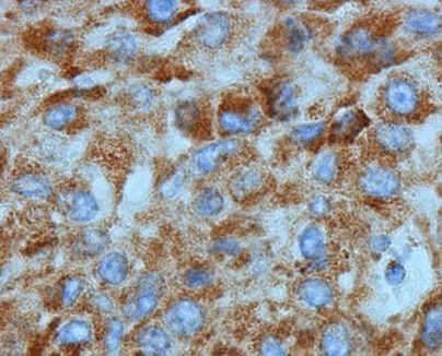 N-cadherin Antibody in Immunohistochemistry (Paraffin) (IHC (P))