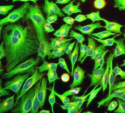 alpha Tubulin Antibody in Immunocytochemistry (ICC/IF)