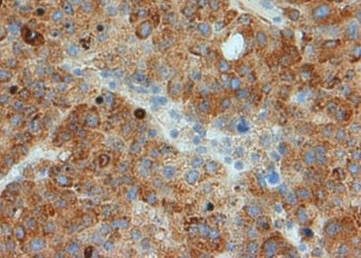 GRP78 Antibody in Immunohistochemistry (Paraffin) (IHC (P))