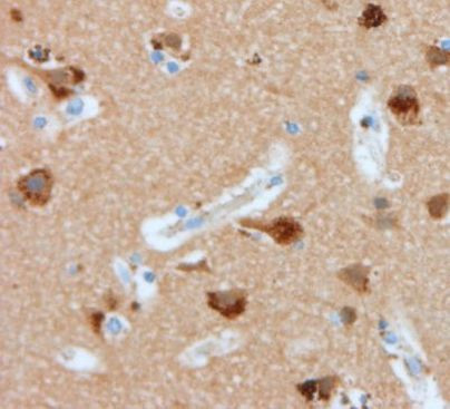 Nucleolin Antibody in Immunohistochemistry (Paraffin) (IHC (P))