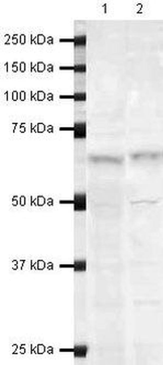 LGI1 Antibody in Western Blot (WB)