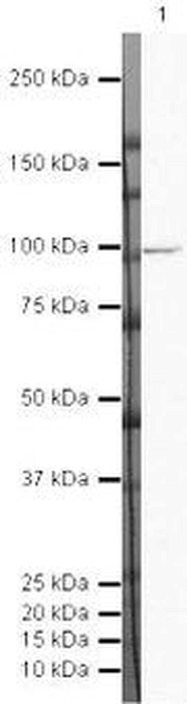 DAB2 Antibody in Western Blot (WB)