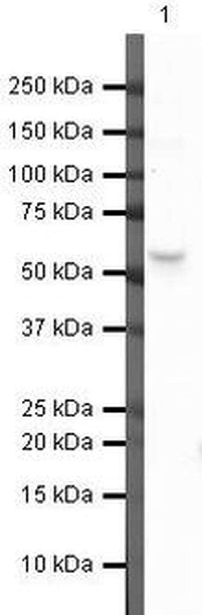 SATB2 Antibody in Western Blot (WB)