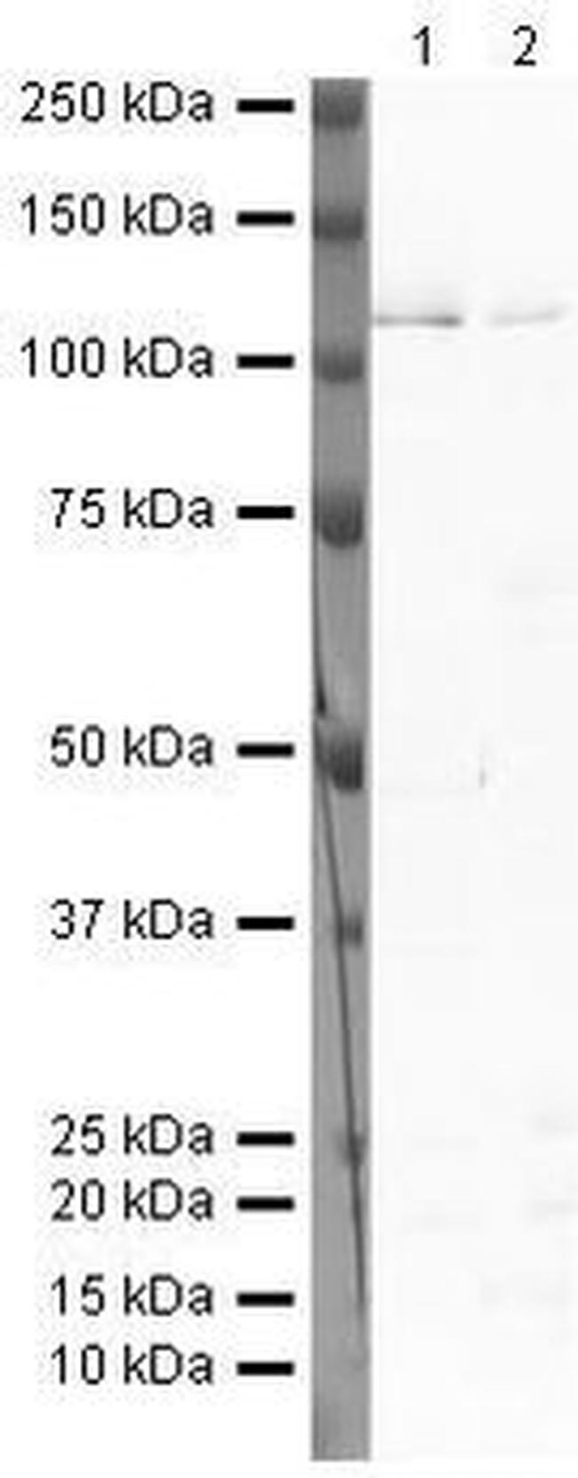 PROX1 Antibody in Western Blot (WB)