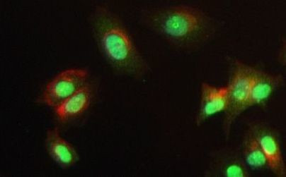 MSK2 Antibody in Immunocytochemistry (ICC/IF)