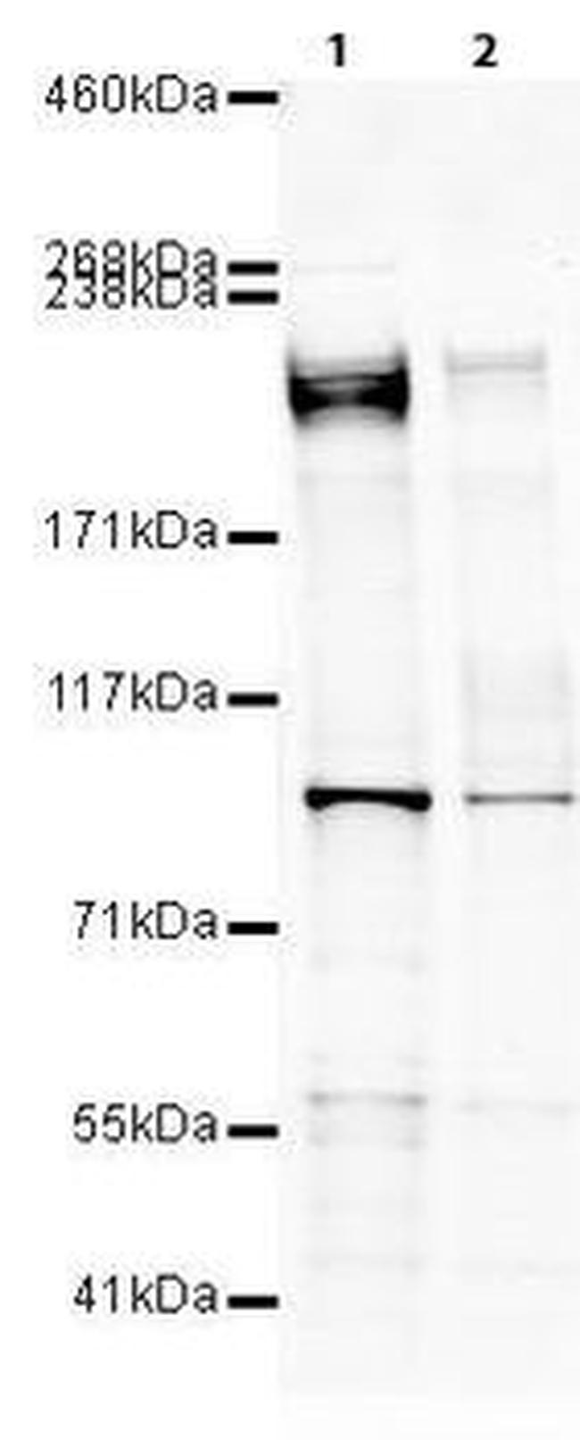eIF4G Antibody in Western Blot (WB)