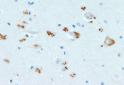 SCF Antibody in Immunohistochemistry (Paraffin) (IHC (P))