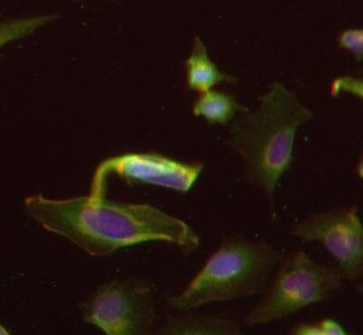 Kindlin Antibody in Immunocytochemistry (ICC/IF)