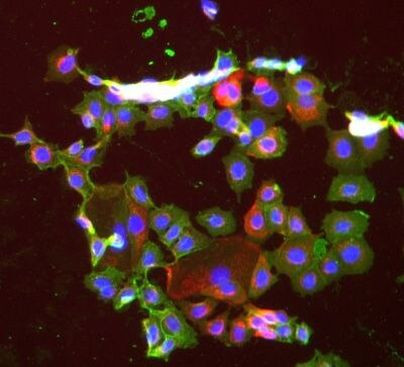 EpCAM Antibody in Immunocytochemistry (ICC/IF)