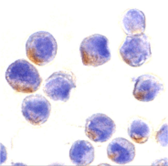 STAT1 Antibody in Immunocytochemistry (ICC/IF)