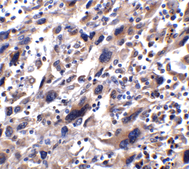 STAT1 Antibody in Immunohistochemistry (Paraffin) (IHC (P))