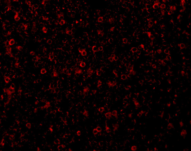 CCR3 Antibody in Immunohistochemistry (IHC)