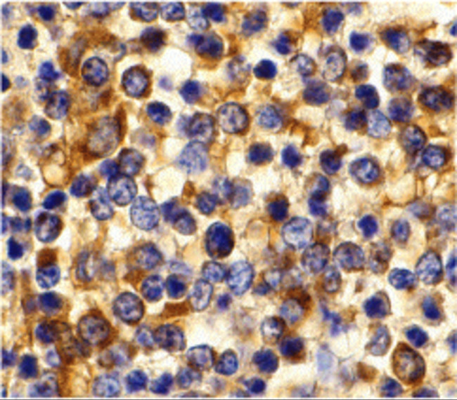 CCR3 Antibody in Immunohistochemistry (IHC)