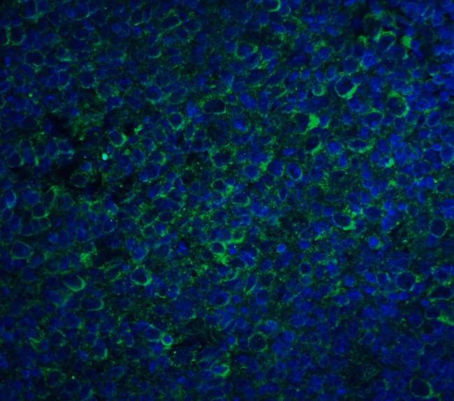 CCR5 Antibody in Immunohistochemistry (IHC)