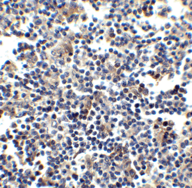 CCR5 Antibody in Immunohistochemistry (IHC)