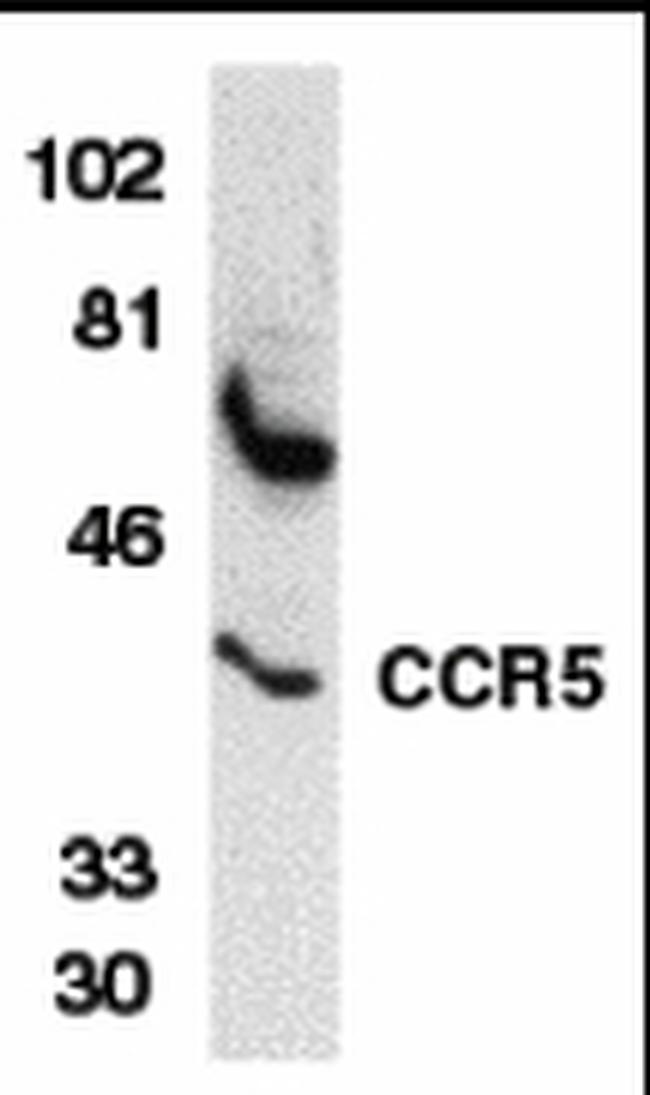 CCR5 Antibody in Western Blot (WB)