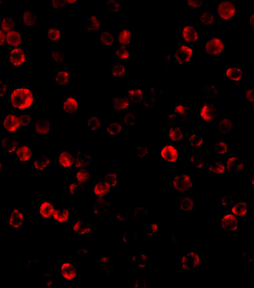 RAIDD Antibody in Immunocytochemistry (ICC/IF)