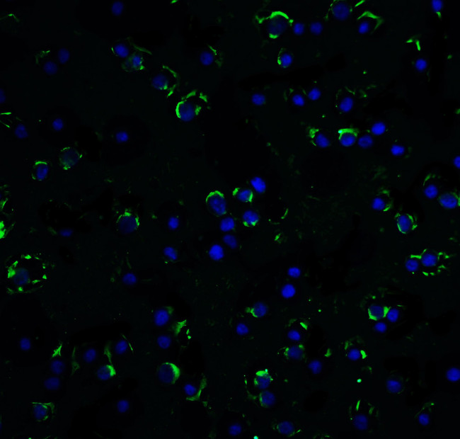 RAIDD Antibody in Immunocytochemistry (ICC/IF)