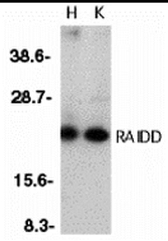 RAIDD Antibody in Western Blot (WB)