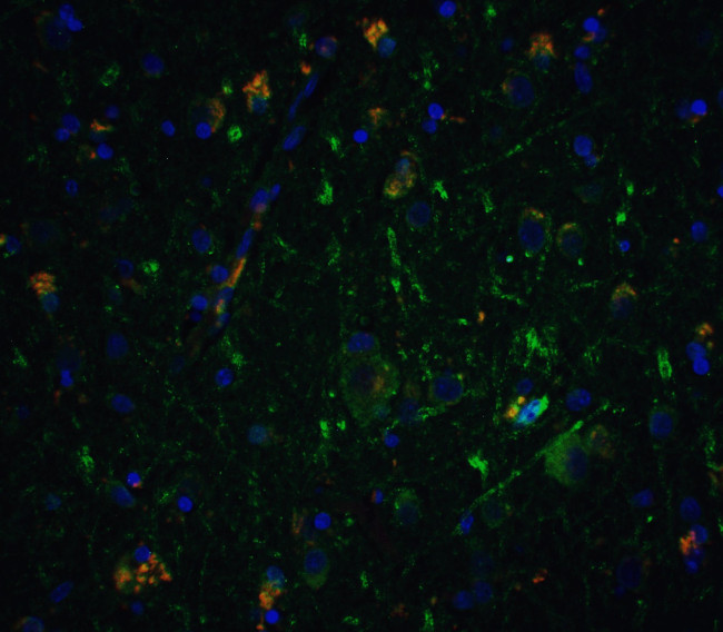 Neurturin Antibody in Immunohistochemistry (IHC)