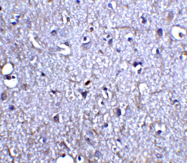 Neurturin Antibody in Immunohistochemistry (IHC)