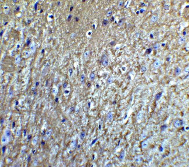 Neurturin Antibody in Immunohistochemistry (IHC)