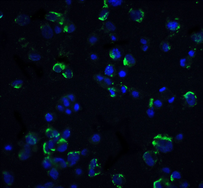 NIK Antibody in Immunocytochemistry (ICC/IF)