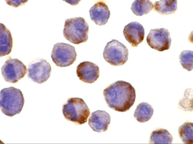 ADAM17 Antibody in Immunocytochemistry (ICC/IF)