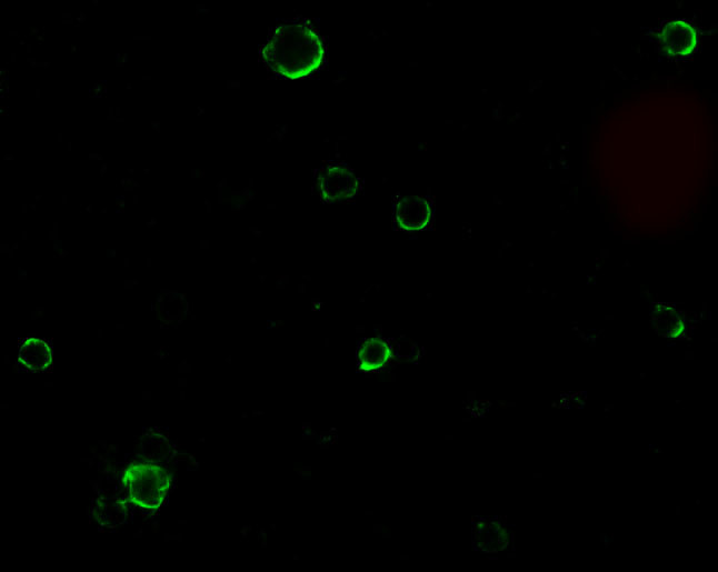 ADAM17 Antibody in Immunocytochemistry (ICC/IF)