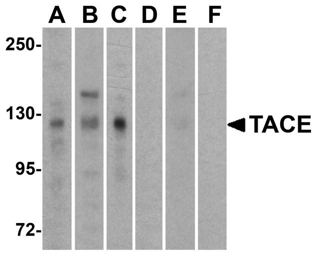 ADAM17 Antibody in Western Blot (WB)