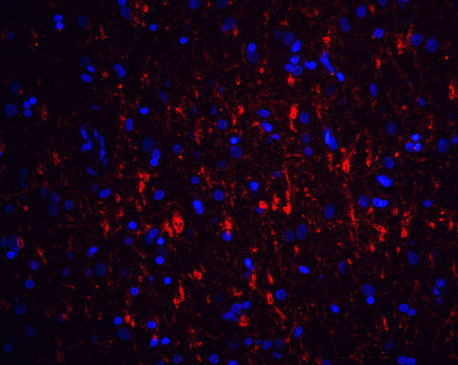 GFR alpha-1 Antibody in Immunohistochemistry (IHC)