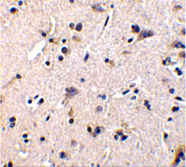 GFR alpha-1 Antibody in Immunohistochemistry (IHC)