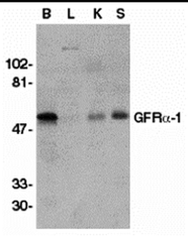 GFR alpha-1 Antibody in Western Blot (WB)