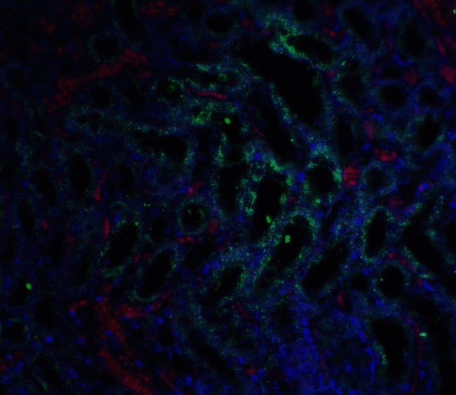 GFR alpha-3 Antibody in Immunohistochemistry (IHC)