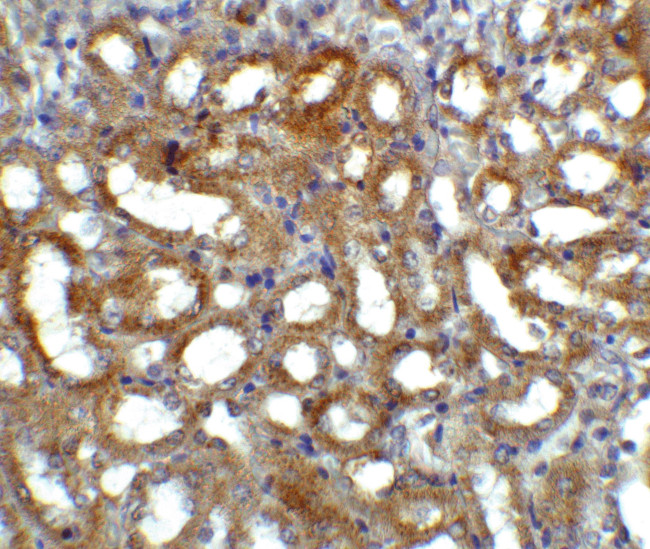 GFR alpha-3 Antibody in Immunohistochemistry (IHC)