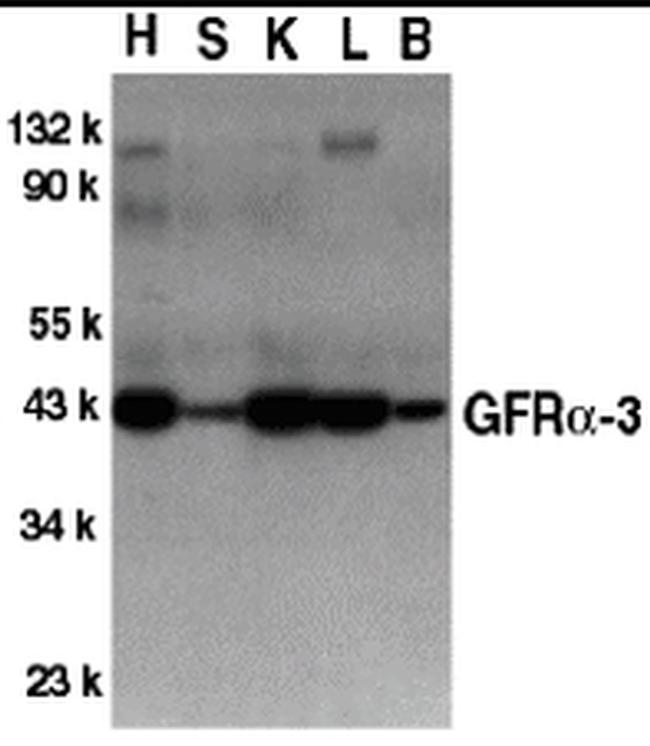 GFR alpha-3 Antibody in Western Blot (WB)