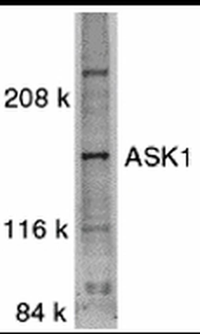 ASK1 Antibody in Western Blot (WB)