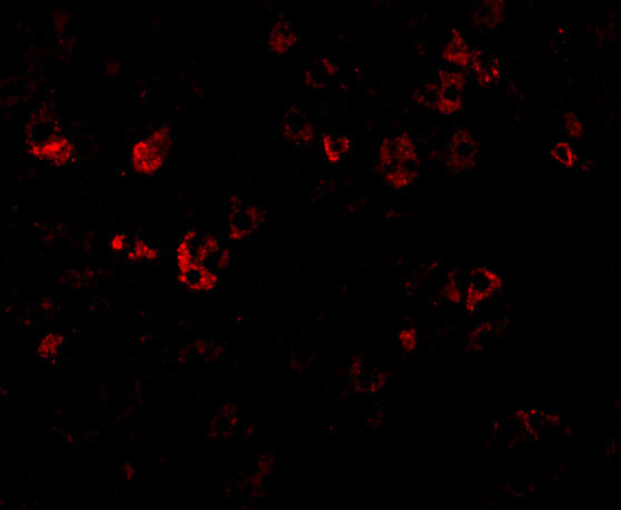 DFFB Antibody in Immunocytochemistry (ICC/IF)