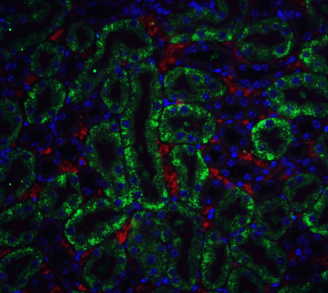 DFFB Antibody in Immunohistochemistry (IHC)