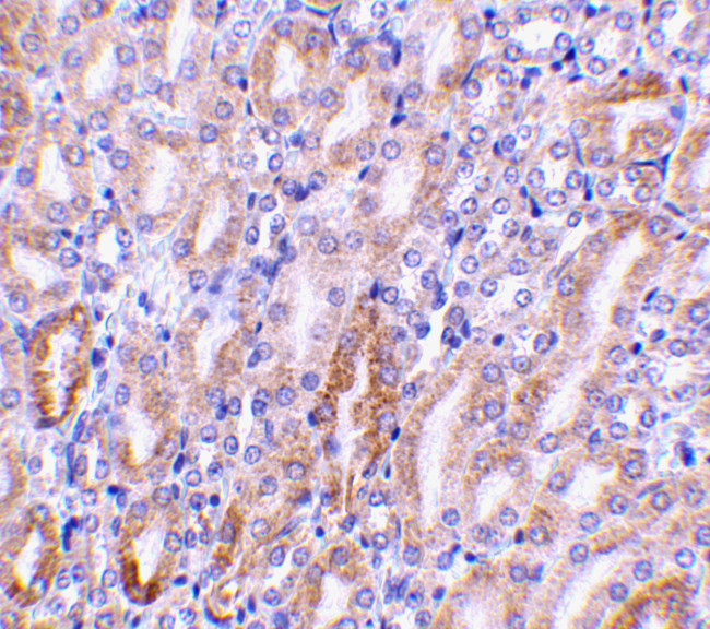 DFFB Antibody in Immunohistochemistry (IHC)