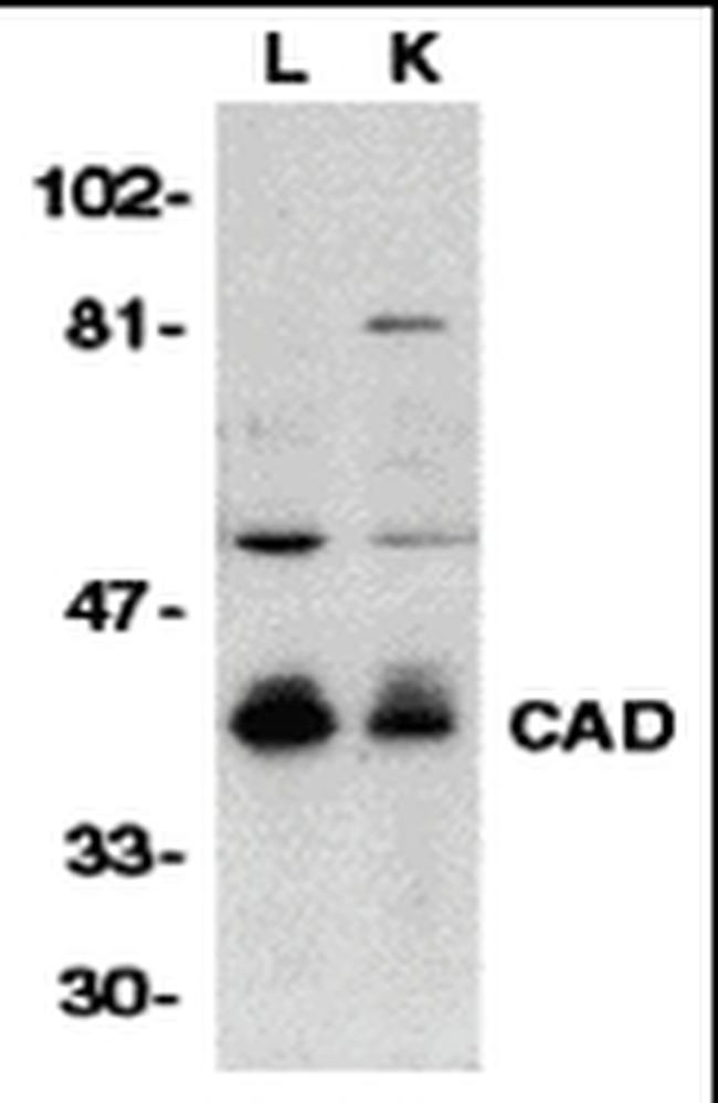 DFFB Antibody in Western Blot (WB)