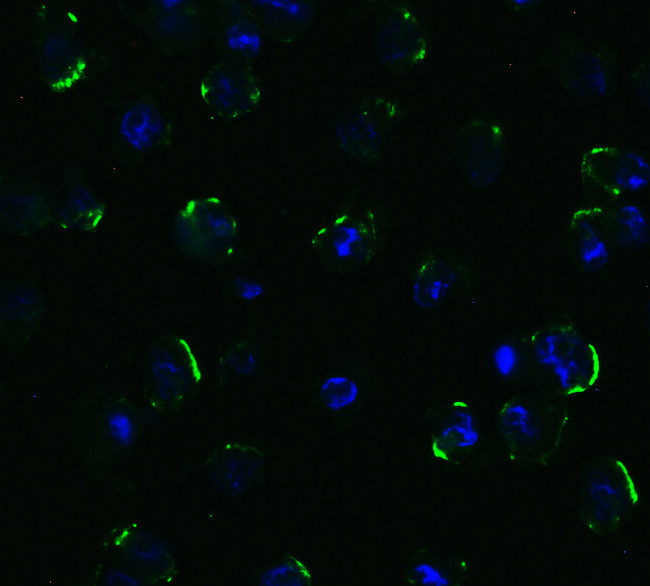 TRAIL-R2 (DR5) Antibody in Immunocytochemistry (ICC/IF)