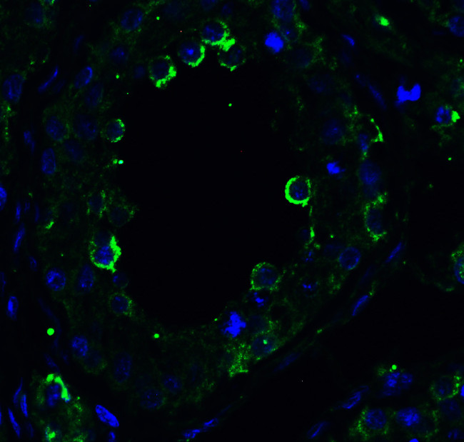 TRAIL-R2 (DR5) Antibody in Immunohistochemistry (Paraffin) (IHC (P))