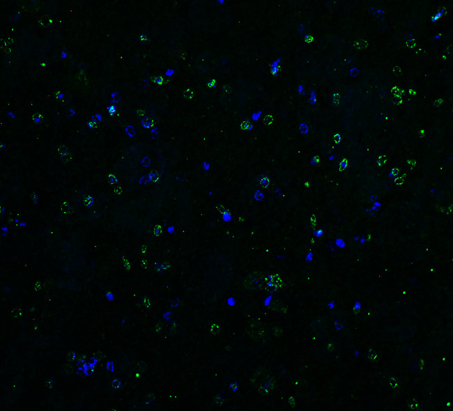 TRAIL-R2 (DR5) Antibody in Immunohistochemistry (Paraffin) (IHC (P))