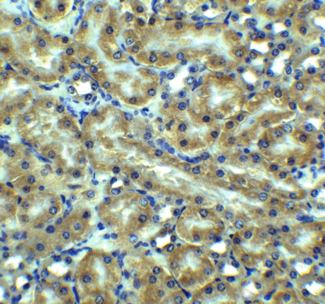 TRAIL-R2 (DR5) Antibody in Immunohistochemistry (Paraffin) (IHC (P))