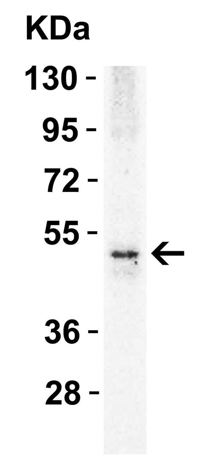 TRAIL-R2 (DR5) Antibody in Western Blot (WB)